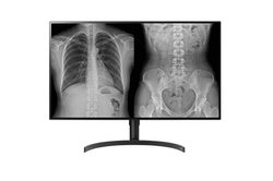 LG 32HL512D - MONITEUR DE DIAGNOSTIC 31.5p - 8Mp - 450cd/m� - HDMI/DP